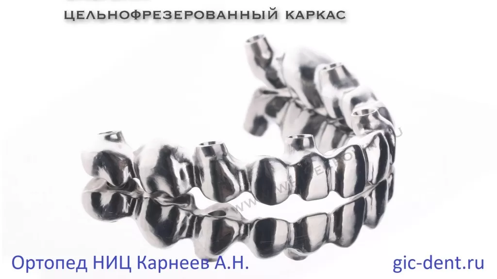 Каркас из кобальт хрома для металлокерамического зубного протеза. Немецкий Имплантологический Центр, Москва